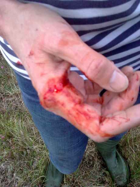 Click on image to see full-sized version injury from IRMS